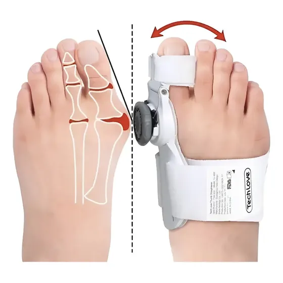 Corrector De Juanete Perilla Regulable Nueva Tecnologia