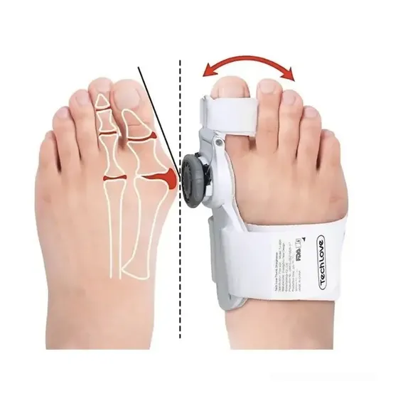 Corrector Juanetes Perilla Regulable Ferula Ortopedica